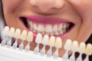 dentist-examining-female-patient-with-teeth- Zirkonium-Kronen in der Türkei Für eine Zahnkronenbehandlung mit Zirkonium Aufenthalt in der Türkei einplanen